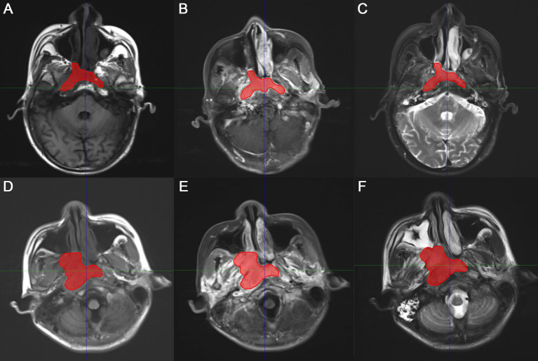 Figure 2