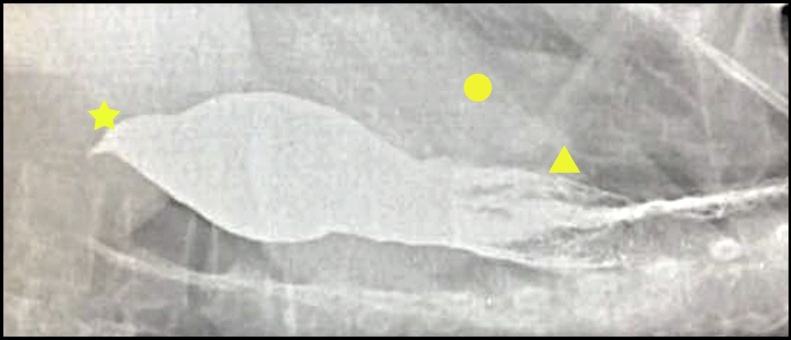 Fig. 2