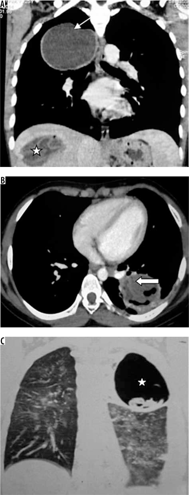 Figure 9