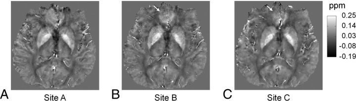 Fig 4.