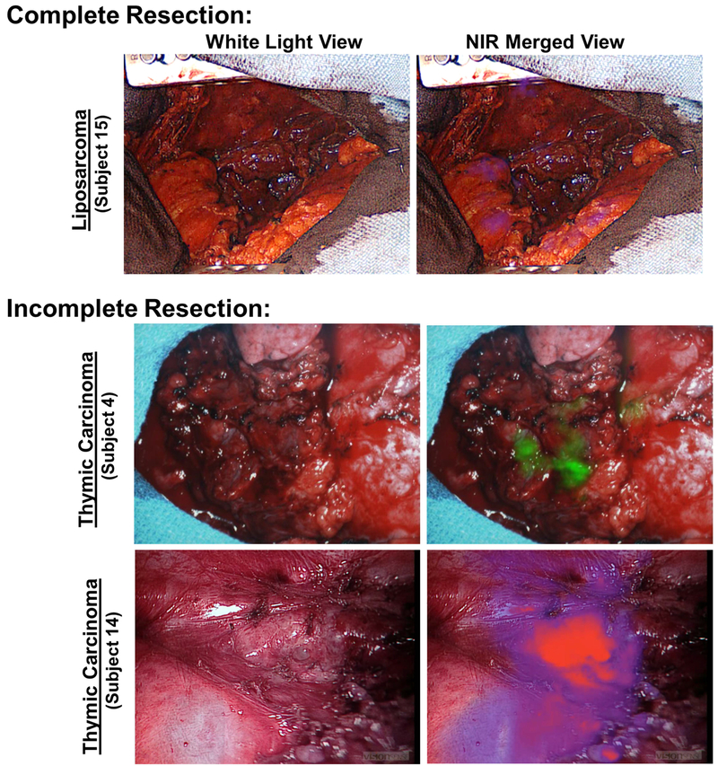 Figure 4: