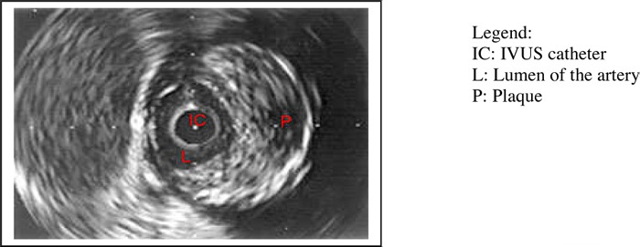 Figure 4: