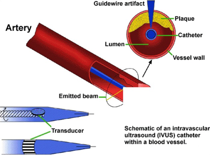 Figure 3: