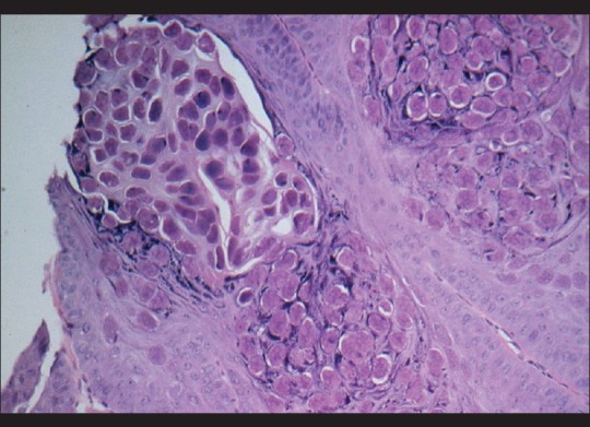 Figure 17