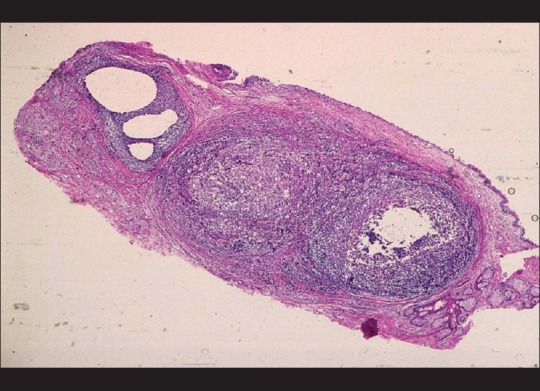 Figure 16
