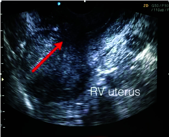 Figure 10.