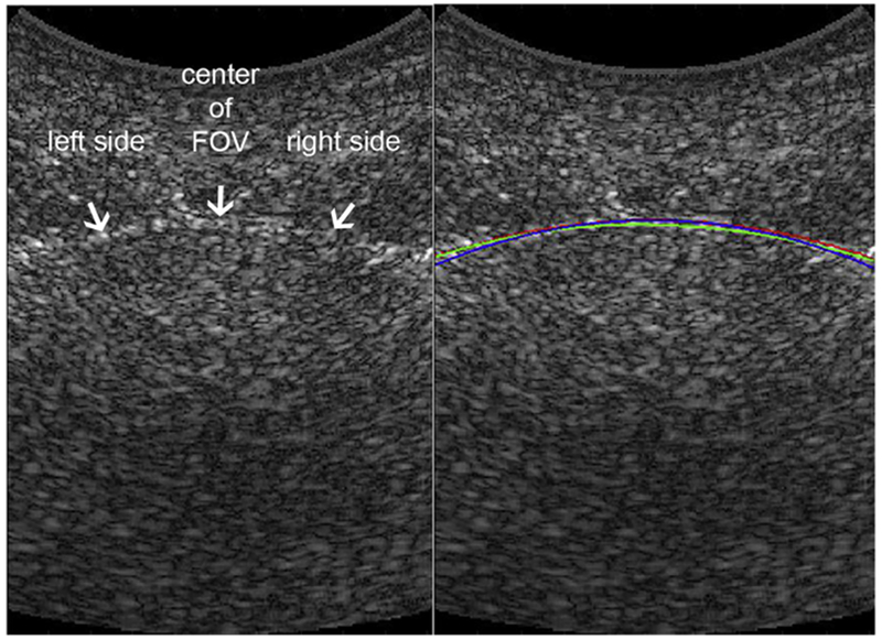 Fig. 2.