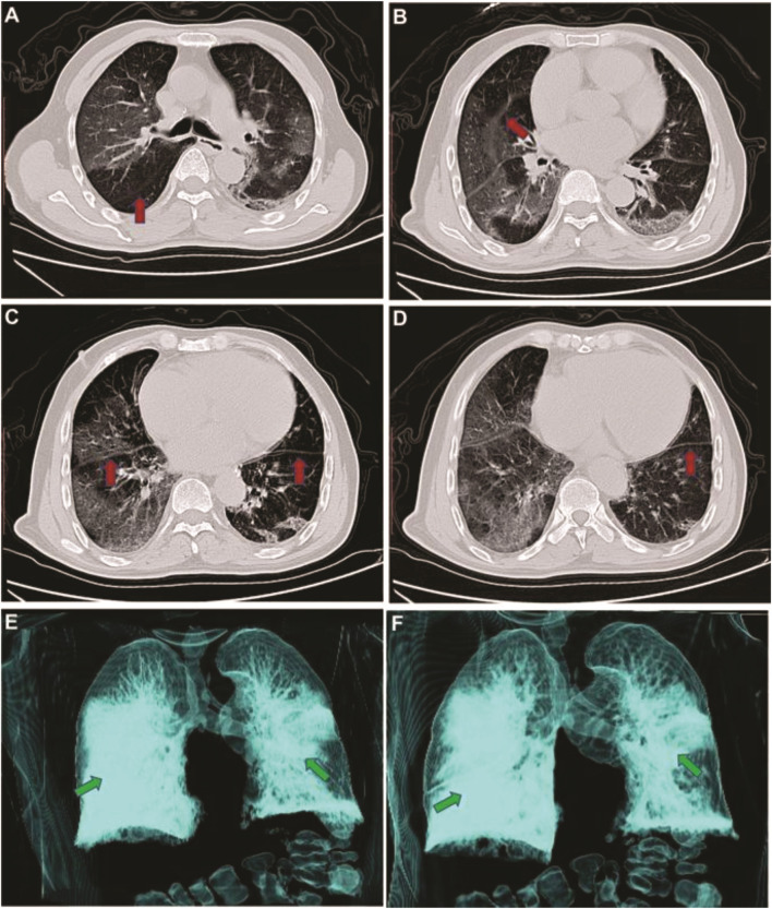 FIGURE 3