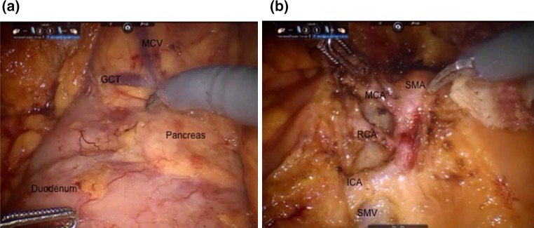 Fig. 4