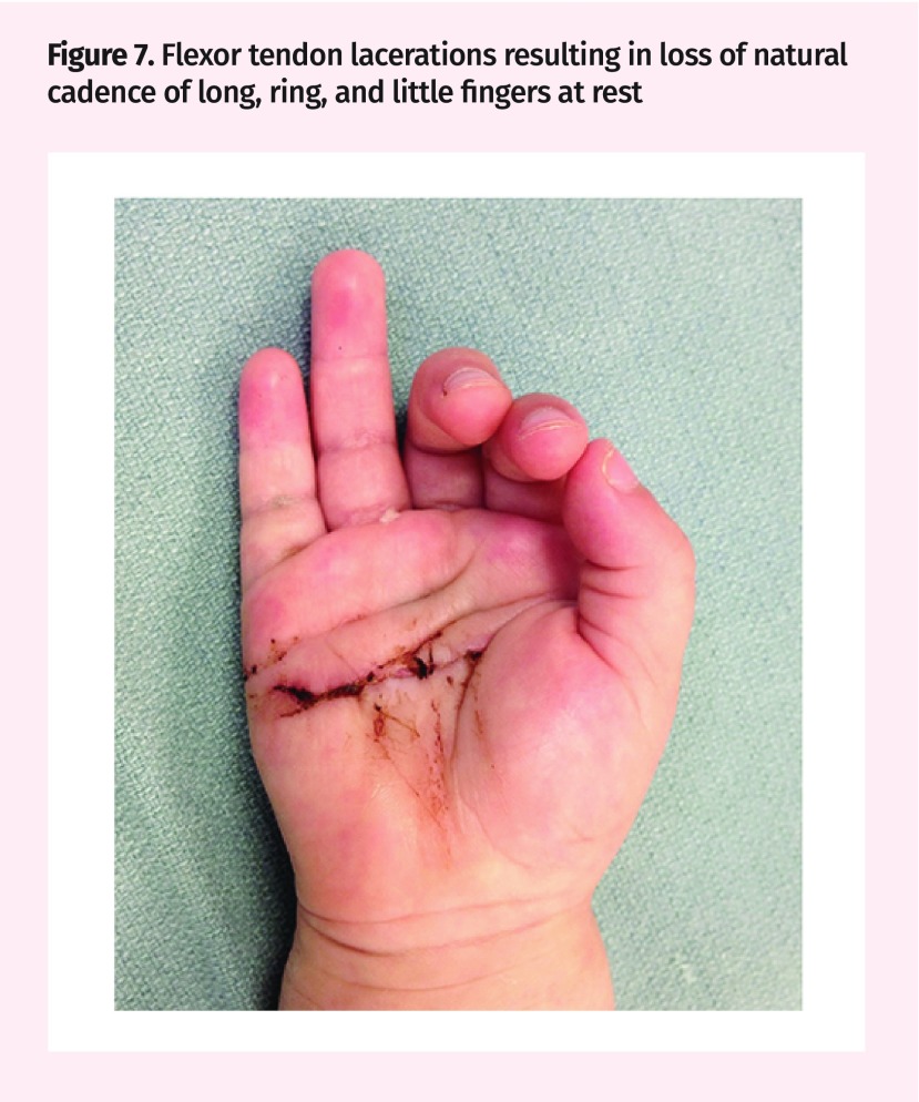 Figure 7.