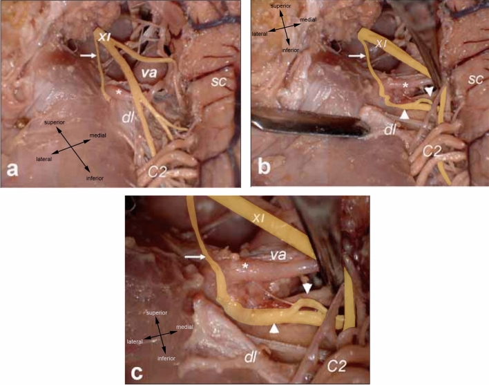 Fig. 4