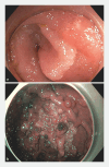 Fig. 1