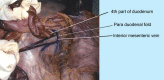 [Table/Fig-6]: