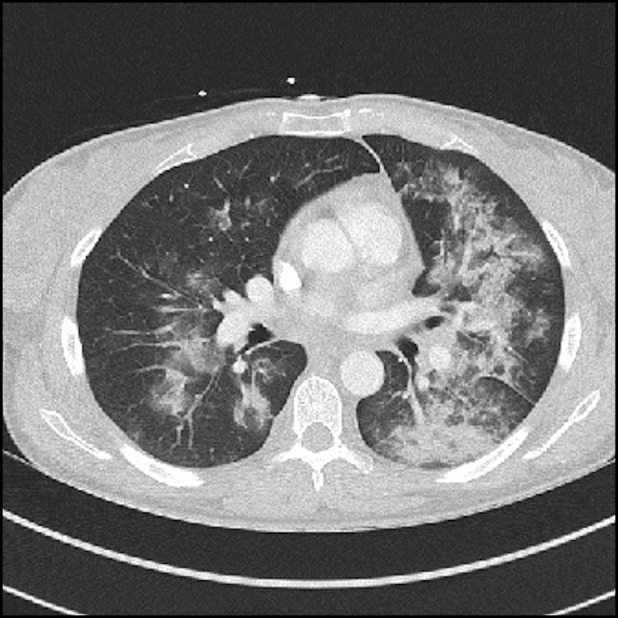 Figure 1