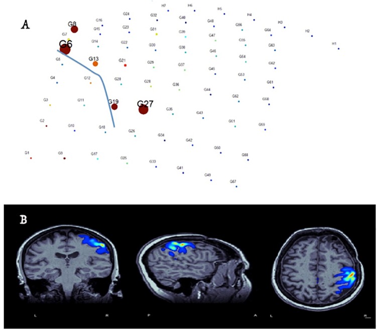 FIGURE 4