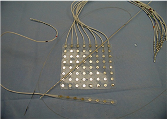 FIGURE 1