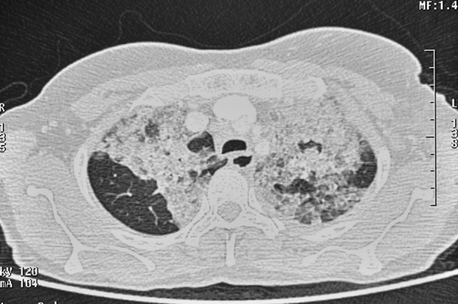 Fig. 2