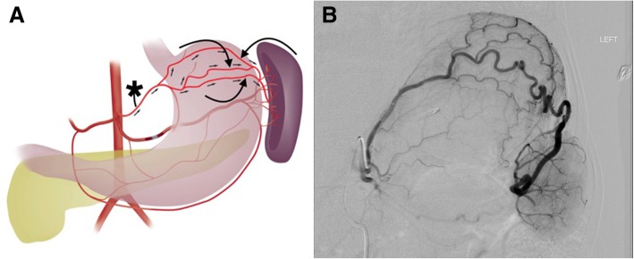 Fig. 10