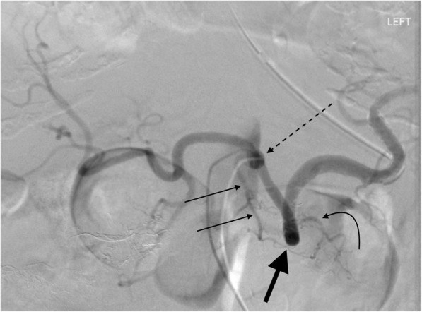 Fig. 2