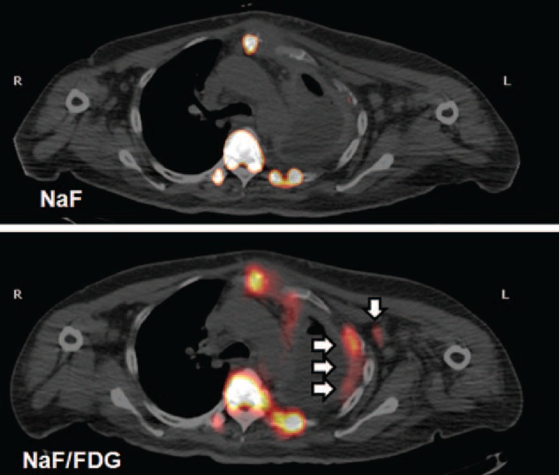 FIGURE 3