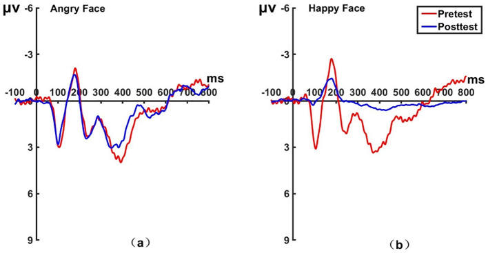Figure 11
