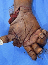 Fig. 1