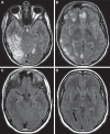 FIGURE 11.