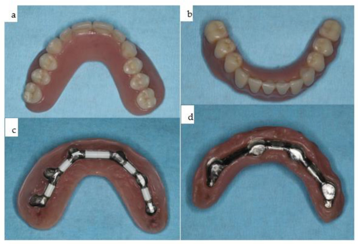 Figure 23