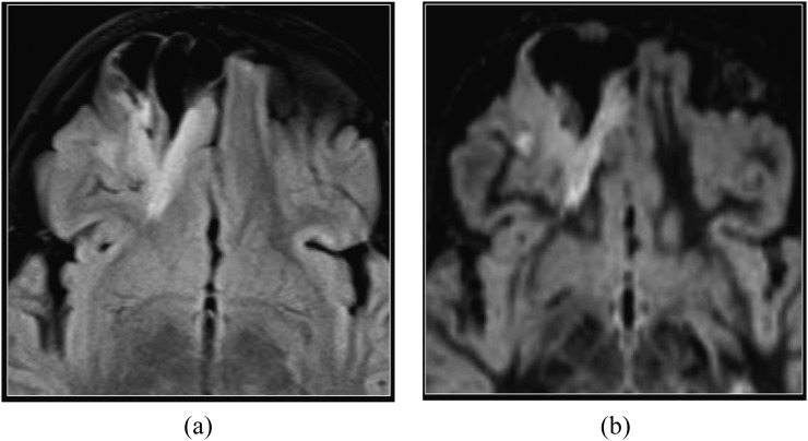 Figure 10.