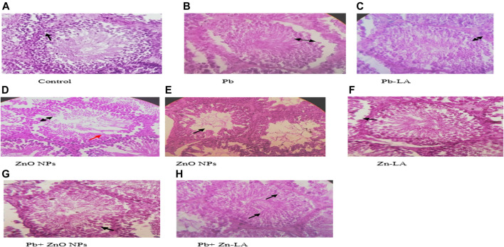 FIGURE 16