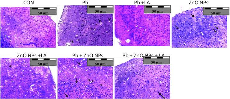 FIGURE 14