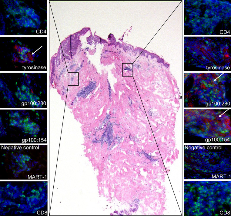 Fig. 4