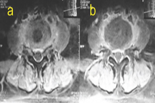 Figure 4a & b