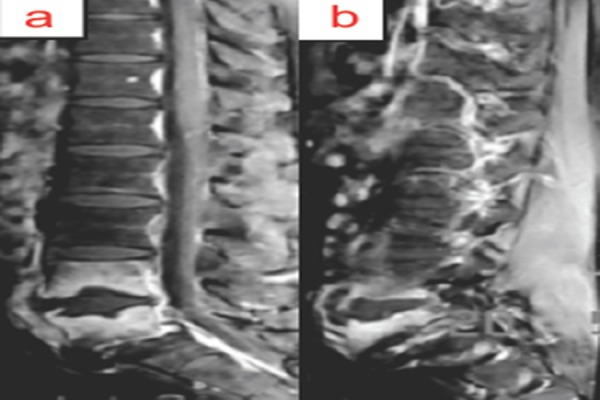 Figure 3a & b