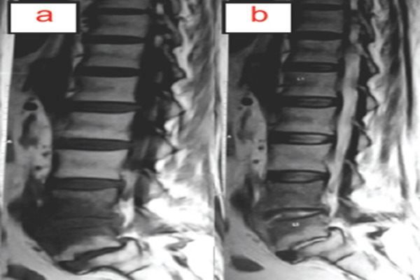 Figure 2a