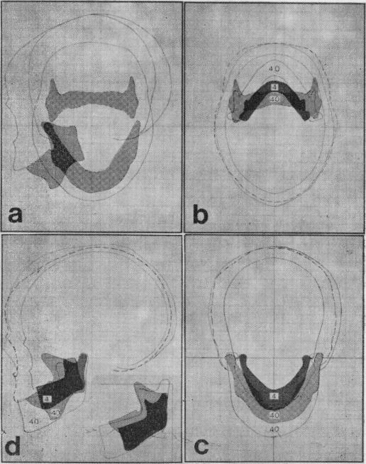 Fig 10