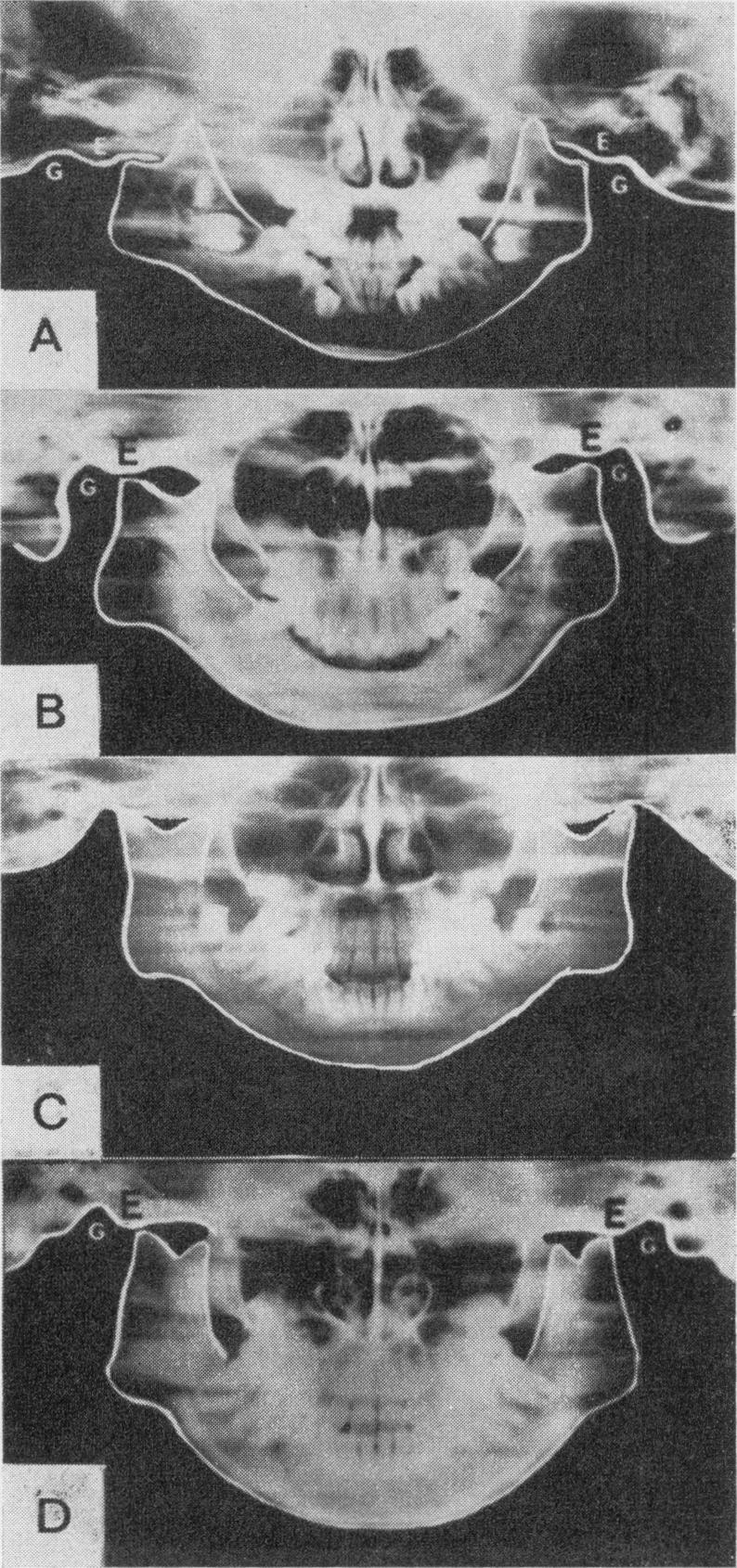 Fig 8