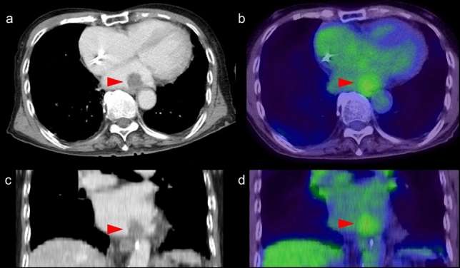 Fig. 13