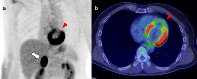 Fig. 10