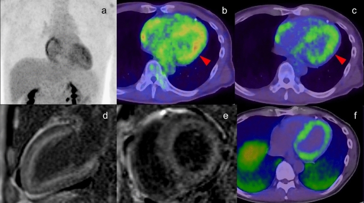 Fig.15