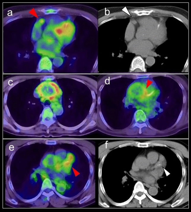 Fig. 16