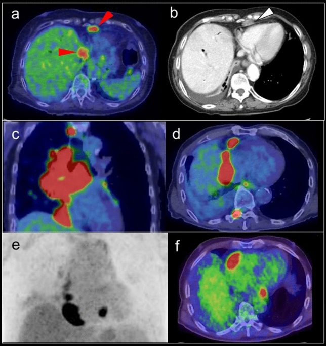 Fig. 17