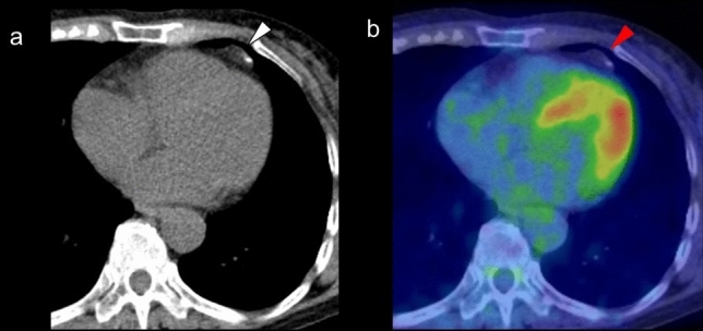 Fig. 18