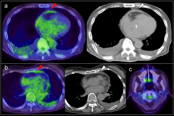 Fig. 19