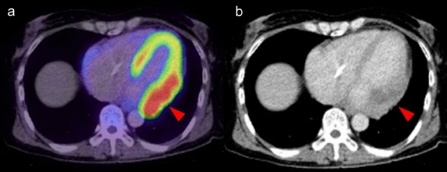 Fig. 14