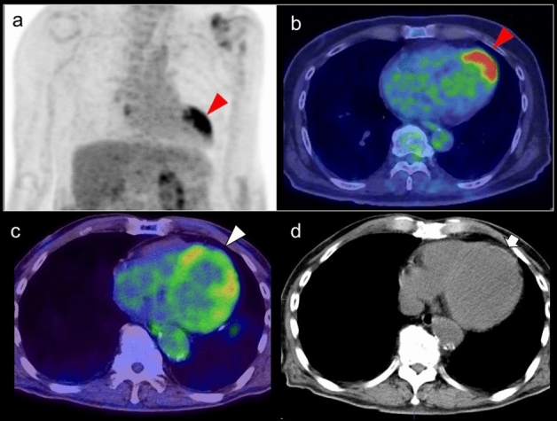 Fig. 9