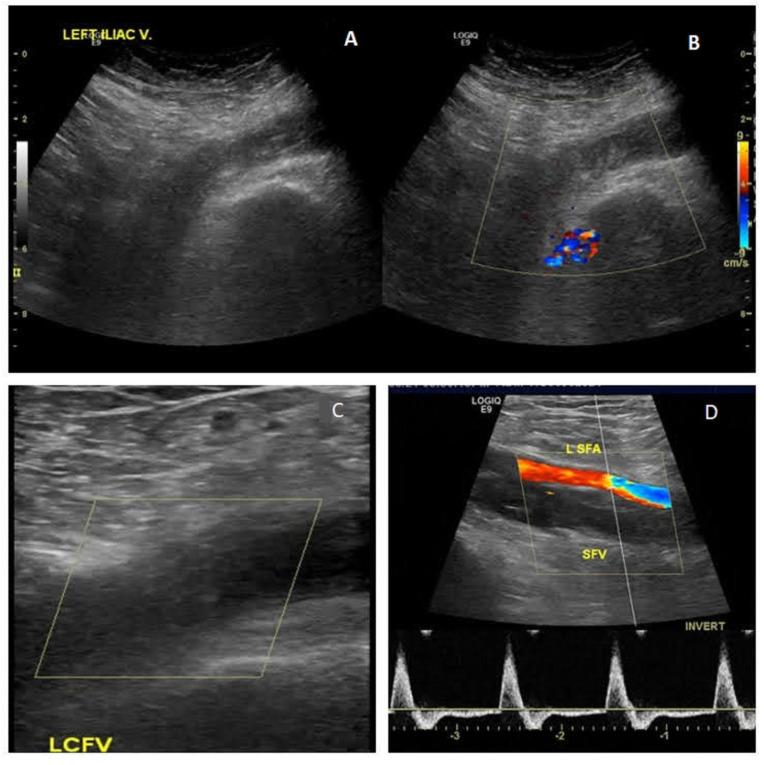 Fig. 1