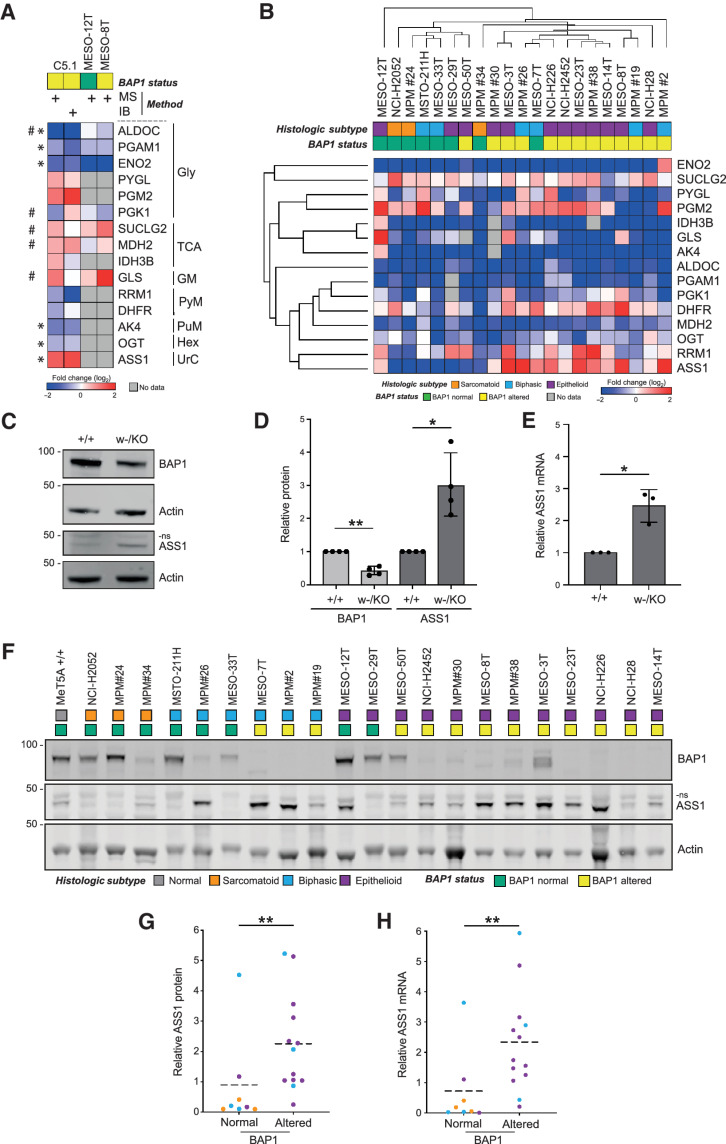 Figure 4. ASS1 expression is a metabolic BAP1 dependency in isogenic MeT5A and MPM cell lines. A, Heatmap comparing expression in BAP1w-/KO C5.1 cells determined by SILAC-MS or immunoblotting (IB, three independent experiments, supporting data in Supplementary Fig. S9), with SILAC-MS data (n = 1; supporting data, Supplementary Table S3) for two epithelioid MPM cell lines: MESO-8T (BAP1-altered), MESO-12T (BAP1-normal). *Significant modulation confirmed in MeT5A by immunoblotting, #data for MESO-8T versus MESO-12T consistent with BAP1 dependency in MeT5A. Gly, glycolysis; TCA, tricarboxylic acid cycle; GM, glycogen metabolism; PyM, pyrimidine metabolism; PuM, purine metabolism; Hex, hexosamine biosynthesis; UrC, urea cycle. B, Unsupervised hierarchical clustering for expression in 21 MPM cell lines determined by immunoblotting. Heatmap shows protein levels for selected metabolic enzymes in cell lines relative to BAP1+/+ MeT5A. Key indicates histologic subtype and BAP1 status, supporting data in Supplementary Figs. S10 and S11. ASS1 protein levels increase in BAP1w-/KO MeT5A cells. Representative immunoblot with anti-ASS1 antibody (Millipore; C) and quantification (D). Mean of four independent experiments, error bars SD; Welch t test; *, P = 0.026; **, P = 0.003; ns, non-specific band. E, ASS1 mRNA expression increases in BAP1w-/KO MeT5A cells. ASS1 qRT-PCR normalized to ACTB and GAPDH; mean of three independent experiments, error bars SD; Welch t test; *, P = 0.021. F–H, ASS1 protein and mRNA expression are significantly higher in BAP1-altered than BAP1-normal MPM cell lines. Representative immunoblot for the cell panel (F); histologic subtype and BAP1 status indicated; ns, non-specific band. Mean ASS1 protein level from three independent experiments (G); normalized to actin and relative to MeT5A BAP1+/+, population mean (dashed line), Mann–Whitney **, P = 0.006. Mean ASS1 mRNA determined by qRT-PCR (H); normalized to ACTB and GAPDH relative to MeT5A BAP1+/+ from three independent experiments, population mean (dashed line), Mann–Whitney **, P = 0.006. For G and H, histologic subtype is indicated in F; supporting data, Supplementary Fig. S12.