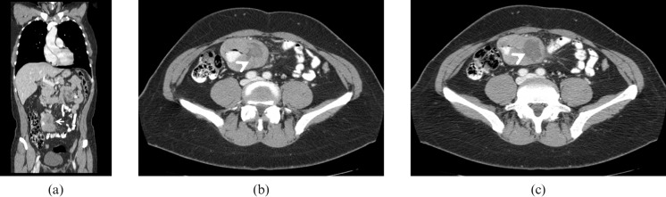 Figure 19