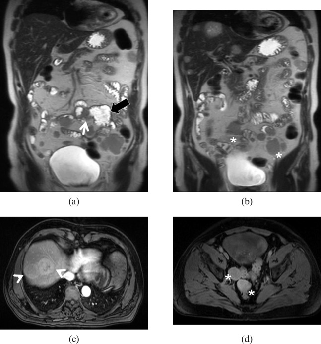 Figure 17